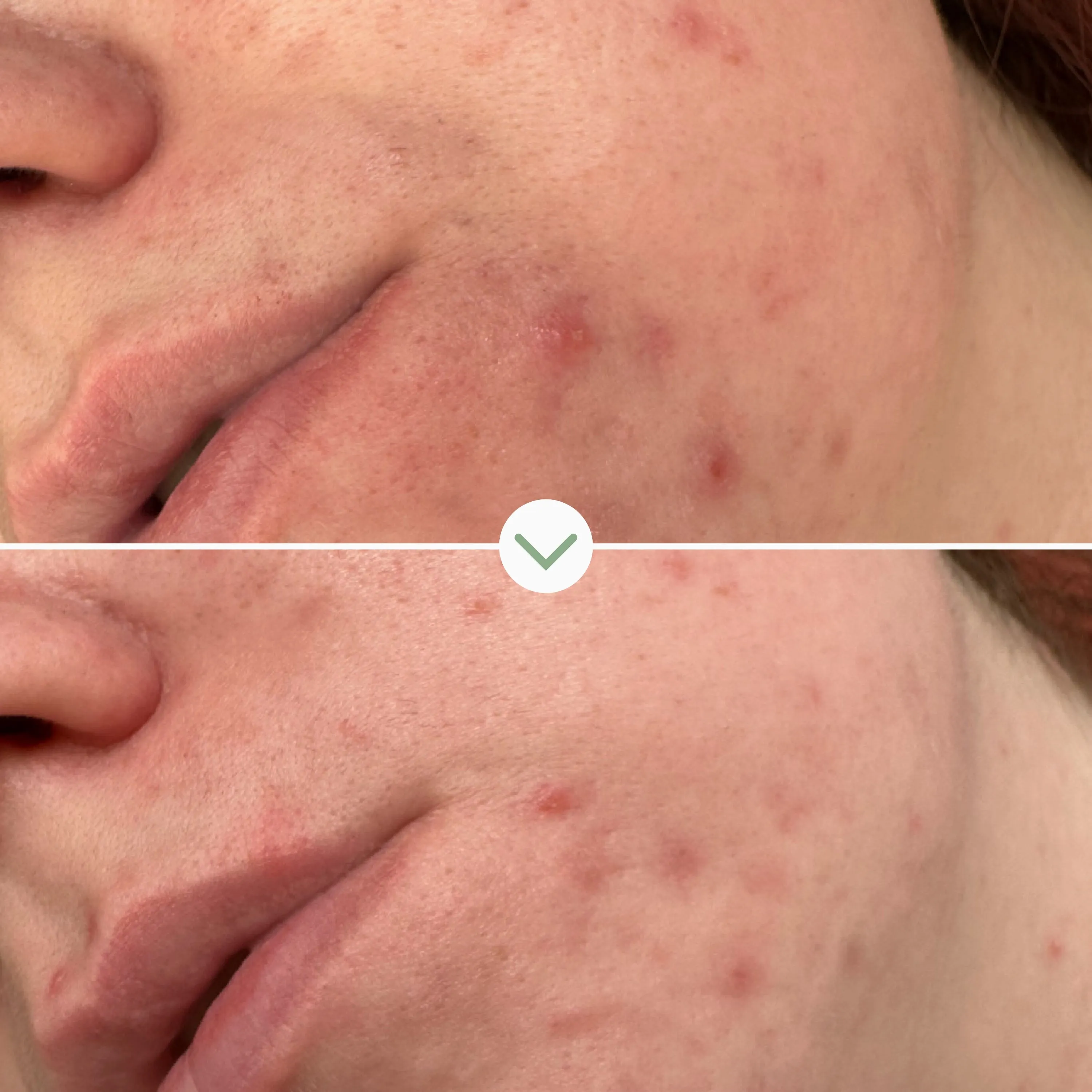 Phaze Rebalance Cleanser