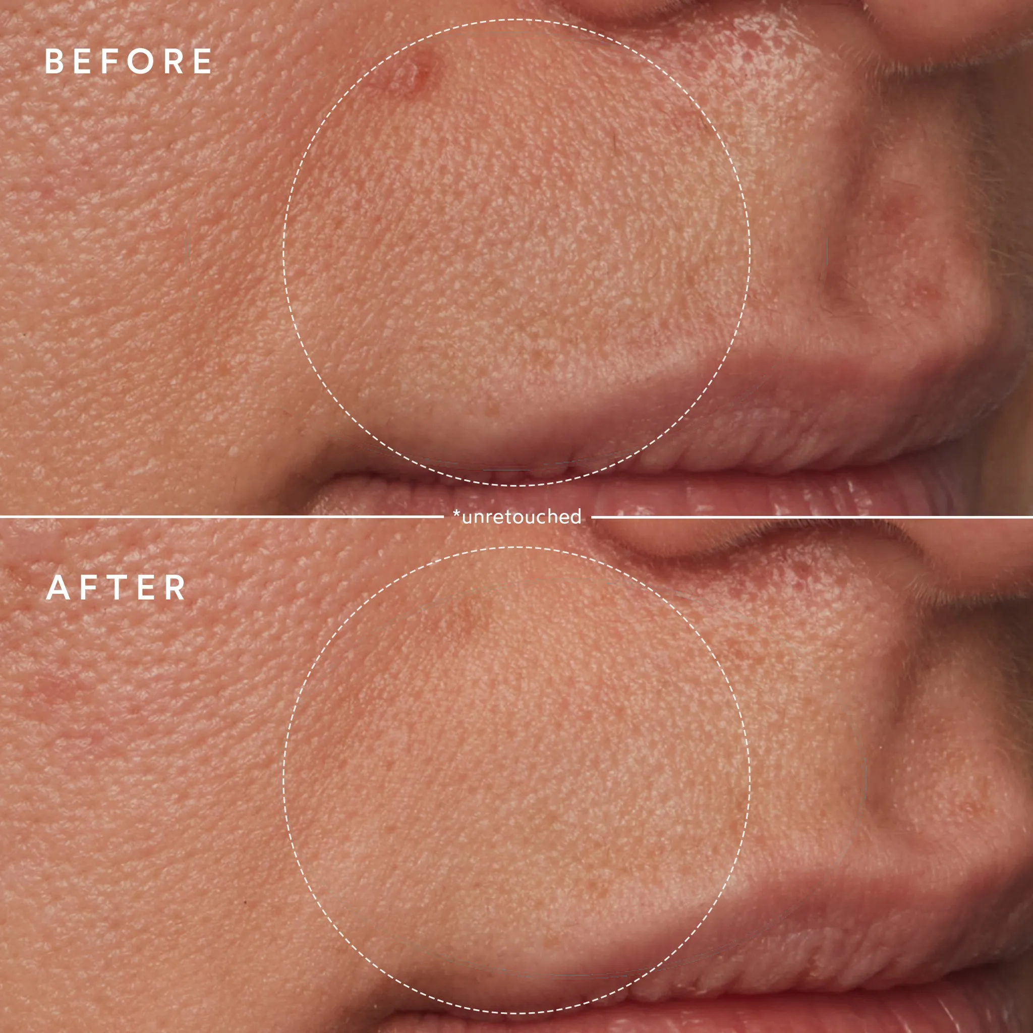Renew Microbiome Enzyme Essence