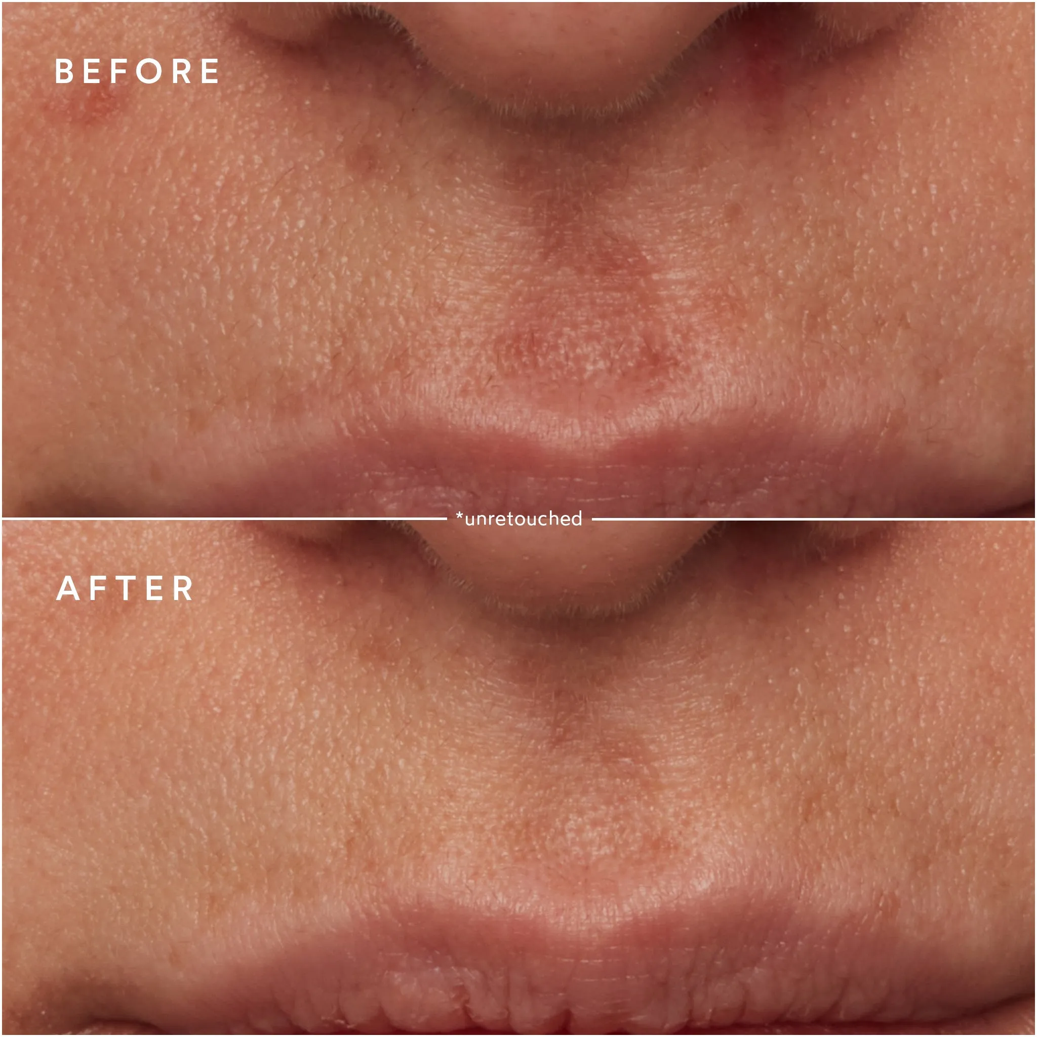 Renew Microbiome Enzyme Essence