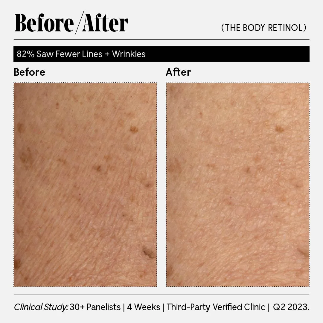 The Body Retinol