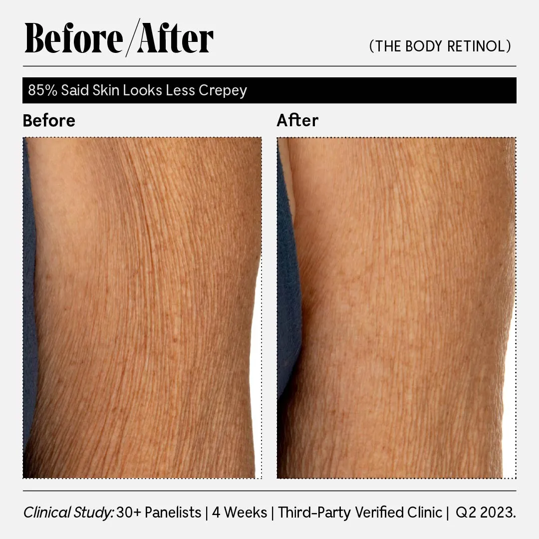 The Body Retinol