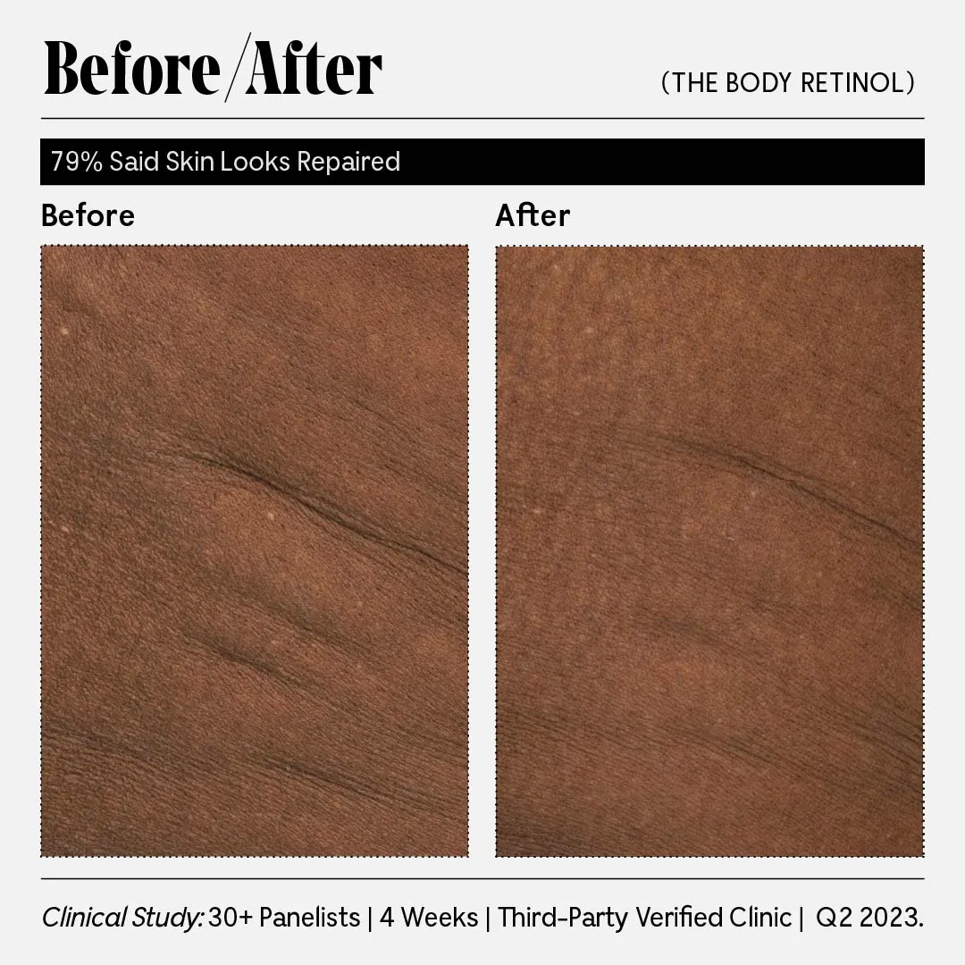 The Body Retinol